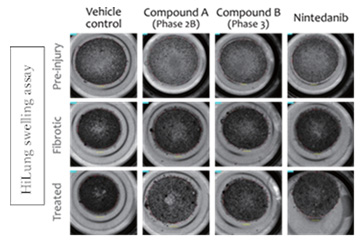 Pulmonary Fibrosis models